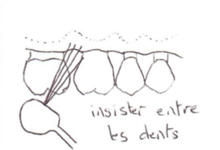 Insister entre les dents - jet dentaire - hygiène buccale