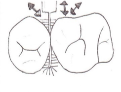 Nettoyer sa dentition avec des brossettes interdentaires